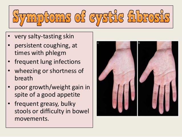 Salty tasting sputum